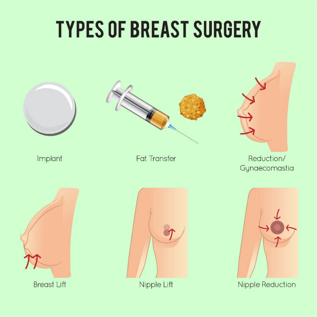 Breast Uplift Surgery Can Be Fun For Everyone thumbnail
